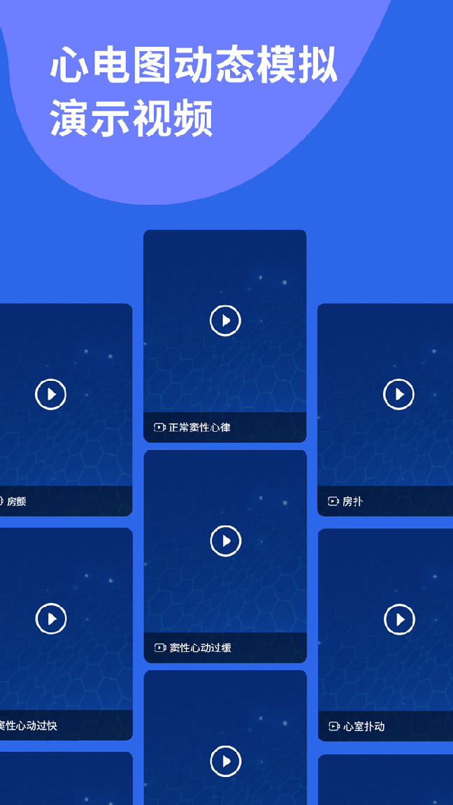 心电图ECG4