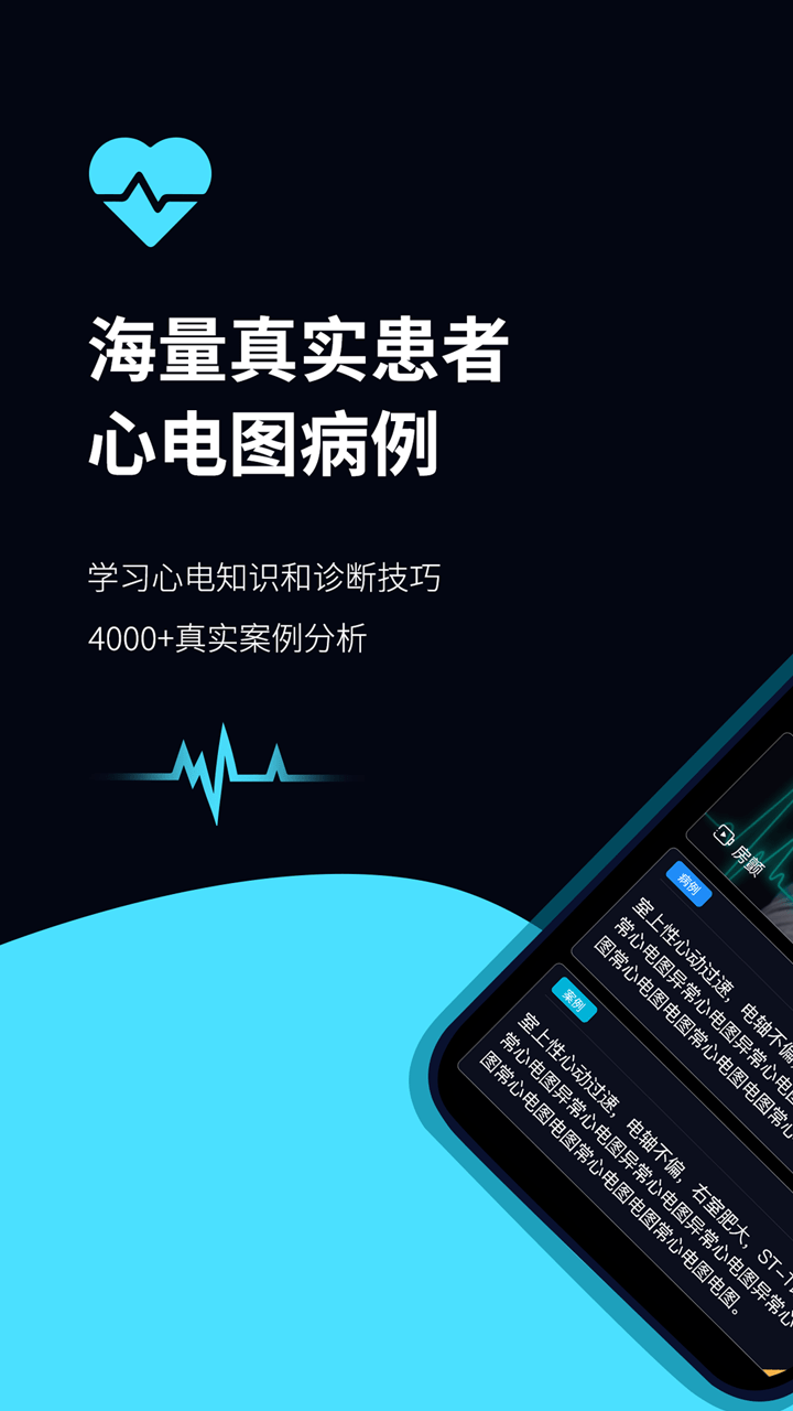 心电图ECG0